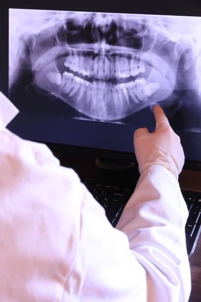 Best Emergency Root Canal Treatment in Toquerville, UT